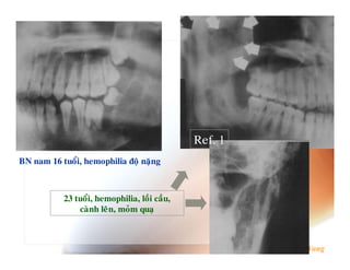 F :8
G-   $ b       6 $ "          &



           A      6 $ "   6       6
                %    6 .$
                      $
 