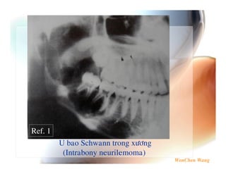 Ref. 1
         Z5      ,    $   7%&
          =[ $ 5 6   $*      >
 