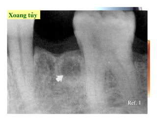 5   .7




         Ref. 1
 