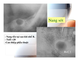 ; 0


0-         4   (
0    89
0!    ""   :


                         F :8
 