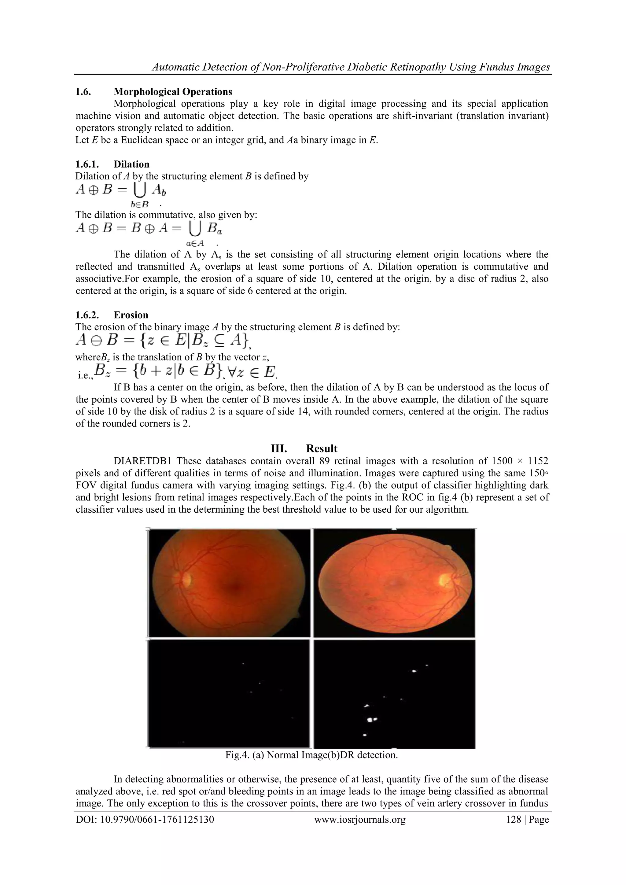Automatic Detection of Non-Proliferative Diabetic Retinopathy Using Fundus Images
DOI: 10.9790/0661-1761125130 www.iosrjournals.org 128 | Page
1.6. Morphological Operations
Morphological operations play a key role in digital image processing and its special application
machine vision and automatic object detection. The basic operations are shift-invariant (translation invariant)
operators strongly related to addition.
Let E be a Euclidean space or an integer grid, and Aa binary image in E.
1.6.1. Dilation
Dilation of A by the structuring element B is defined by
.
The dilation is commutative, also given by:
.
The dilation of A by As is the set consisting of all structuring element origin locations where the
reflected and transmitted As overlaps at least some portions of A. Dilation operation is commutative and
associative.For example, the erosion of a square of side 10, centered at the origin, by a disc of radius 2, also
centered at the origin, is a square of side 6 centered at the origin.
1.6.2. Erosion
The erosion of the binary image A by the structuring element B is defined by:
,
whereBz is the translation of B by the vector z,
i.e., , .
If B has a center on the origin, as before, then the dilation of A by B can be understood as the locus of
the points covered by B when the center of B moves inside A. In the above example, the dilation of the square
of side 10 by the disk of radius 2 is a square of side 14, with rounded corners, centered at the origin. The radius
of the rounded corners is 2.
III. Result
DIARETDB1 These databases contain overall 89 retinal images with a resolution of 1500 × 1152
pixels and of different qualities in terms of noise and illumination. Images were captured using the same 150◦
FOV digital fundus camera with varying imaging settings. Fig.4. (b) the output of classifier highlighting dark
and bright lesions from retinal images respectively.Each of the points in the ROC in fig.4 (b) represent a set of
classifier values used in the determining the best threshold value to be used for our algorithm.
Fig.4. (a) Normal Image(b)DR detection.
In detecting abnormalities or otherwise, the presence of at least, quantity five of the sum of the disease
analyzed above, i.e. red spot or/and bleeding points in an image leads to the image being classified as abnormal
image. The only exception to this is the crossover points, there are two types of vein artery crossover in fundus
 