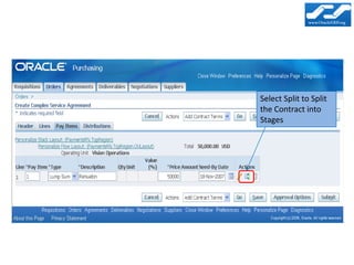 Select Split to Split
the Contract into
Stages
 