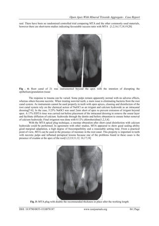 Open Apex with Mineral Trioxide Aggregate- Case Report | PDF