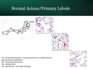 Normal Acinus R16-Medical School Infectious_Pneumonia_2022.pptx