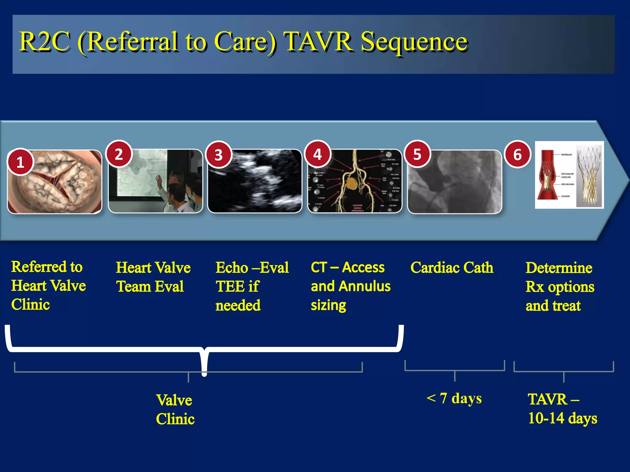 4 531 2 6
< 7 days
R2C (Referral to Care) TAVR Sequence
 