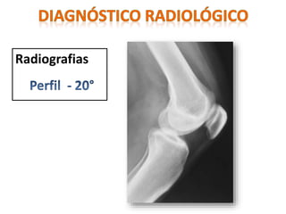 Radiografias
 