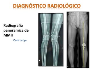 Radiografia
panorâmica de
MMII
 
