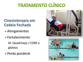 Alongamentos
Fortalecimento
M. Quadríceps / CORE e
glúteos
Perda ponderal
 