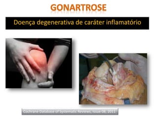 Doença degenerativa de caráter inflamatório
Cochrane Database of Systematic Reviews, Issue 08, 2011
 