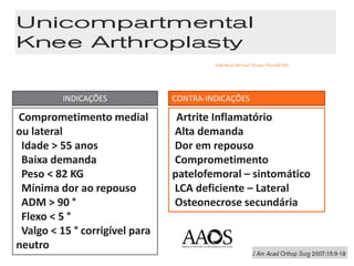 Comprometimento medial
ou lateral
Idade > 55 anos
Baixa demanda
Peso < 82 KG
Mínima dor ao repouso
ADM > 90 °
Flexo < 5 °
Valgo < 15 ° corrigível para
neutro
Artrite Inflamatório
Alta demanda
Dor em repouso
Comprometimento
patelofemoral – sintomático
LCA deficiente – Lateral
Osteonecrose secundária
INDICAÇÕES CONTRA-INDICAÇÕES
Todd Borus MD and Thomas Thornhill MD
 