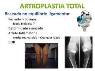 Paciente > 60 anos
Idade biológica ?
Deformidade avançada
Artrite Inflamatória
Artrite reumatoide – Qualquer idade
DOR
 