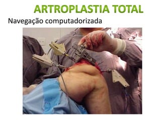 Navegação computadorizada
 