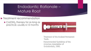 Endodontic Rationale –
Mature Root
 Treatment recommendation
 Ca(OH)2 therapy for as long as
practical, usually 6-12 months
Treatment of the Avulsed Permanent
Tooth.
Recommended Guidelines of the
American Association of
Endodontists, 1995.
 
