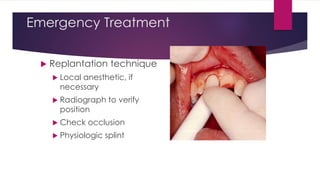 Emergency Treatment
 Replantation technique
 Local anesthetic, if
necessary
 Radiograph to verify
position
 Check occlusion
 Physiologic splint
 