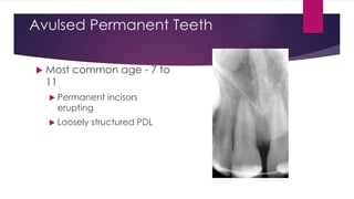 Avulsed Permanent Teeth
 Most common age - 7 to
11
 Permanent incisors
erupting
 Loosely structured PDL
 
