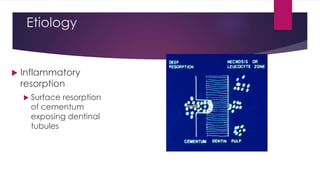 Etiology
 Inflammatory
resorption
 Surface resorption
of cementum
exposing dentinal
tubules
 