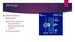 Etiology
 Inflammatory
resorption
 Surface resorption
of cementum
exposing dentinal
tubules
 Pulp necrosis
 
