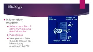 Etiology
 Inflammatory
resorption
 Surface resorption of
cementum exposing
dentinal tubules
 Pulp necrosis
 Toxic products from
the pulp provoke an
inflammatory
response in the PDL
 