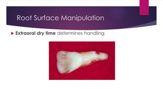 Root Surface Manipulation
 Extraoral dry time determines handling
 