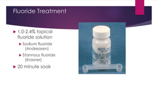 Fluoride Treatment
 1.0-2.4% topical
fluoride solution
 Sodium fluoride
(Andreasen)
 Stannous fluoride
(Krasner)
 20 minute soak
 