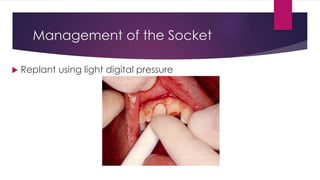 Management of the Socket
 Replant using light digital pressure
 