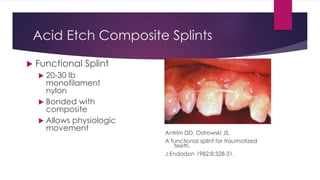 Acid Etch Composite Splints
 Functional Splint
 20-30 lb
monofilament
nylon
 Bonded with
composite
 Allows physiologic
movement
Antrim DD, Ostrowski JS.
A functional splint for traumatized
teeth.
J Endodon 1982;8:328-31.
 