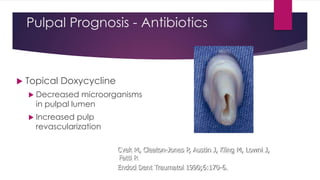 Pulpal Prognosis - Antibiotics
 Topical Doxycycline
 Decreased microorganisms
in pulpal lumen
 Increased pulp
revascularization
Cvek M, Cleaton-Jones P, Austin J, Kling M, Lowni J,
Fatti P.
Endod Dent Traumatol 1990;6:170-6.
 