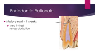Endodontic Rationale
 Mature root - 4 weeks
 Very limited
revascularization
 