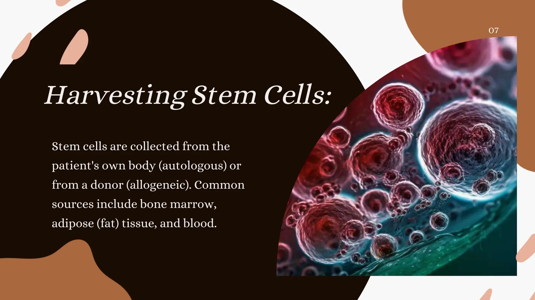 R3 Stem Cell Therapy: A New Hope for Women with Ovarian Failure | PPT