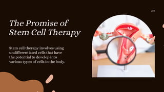R3 Stem Cell Therapy: A New Hope for Women with Ovarian Failure | PPTX