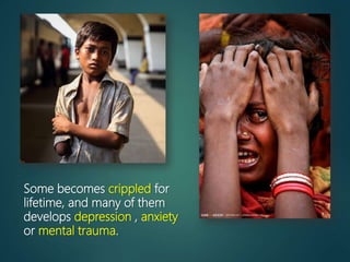 Some becomes crippled for
lifetime, and many of them
develops depression , anxiety
or mental trauma.
 