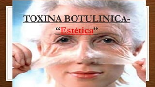 TOXINA BOTULINICA-
“Estética”
 
