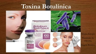 Toxina Botulínica
Silvana Knopf;
Wanderlei de
Oliveira;
Angela Benites.
 