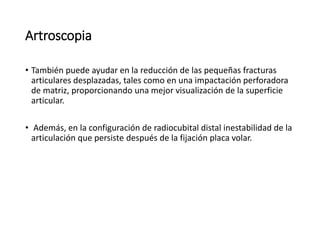 Artroscopia
• También puede ayudar en la reducción de las pequeñas fracturas
articulares desplazadas, tales como en una impactación perforadora
de matriz, proporcionando una mejor visualización de la superficie
articular.
• Además, en la configuración de radiocubital distal inestabilidad de la
articulación que persiste después de la fijación placa volar.
 