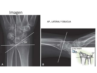 Imagen
AP , LATERAL Y OBLICUA
 