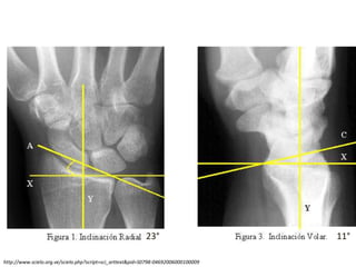 23° 11°
http://www.scielo.org.ve/scielo.php?script=sci_arttext&pid=S0798-04692006000100009
 
