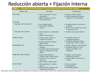 Reducción abierta + Fijación Interna
Distal Radius Fractures: Approaches, Indications, and Techniques. Current concept. Ram K. Alluri. 2016 by the American Society for Surgery of the Hand.
 