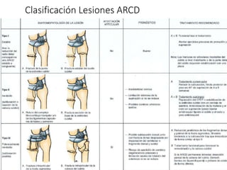 Clasificación Lesiones ARCD
 
