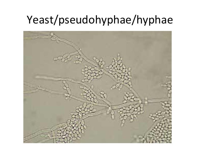 Hyphae Grow At Room Temperature Hyphae Grow At Room Temperature
