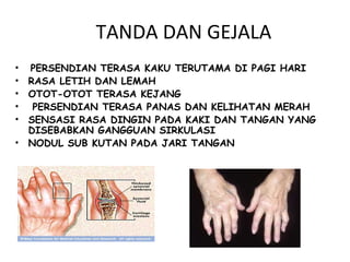 TANDA DAN GEJALA
•   PERSENDIAN TERASA KAKU TERUTAMA DI PAGI HARI
•   RASA LETIH DAN LEMAH
•   OTOT-OTOT TERASA KEJANG
•    PERSENDIAN TERASA PANAS DAN KELIHATAN MERAH
•   SENSASI RASA DINGIN PADA KAKI DAN TANGAN YANG
    DISEBABKAN GANGGUAN SIRKULASI
•   NODUL SUB KUTAN PADA JARI TANGAN
 