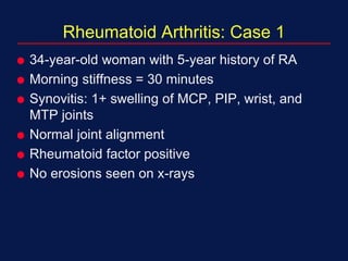 Rheumatoid Arthritis: Case 1
 34-year-old woman with 5-year history of RA
 Morning stiffness = 30 minutes
 Synovitis: 1+ swelling of MCP, PIP, wrist, and
MTP joints
 Normal joint alignment
 Rheumatoid factor positive
 No erosions seen on x-rays
 