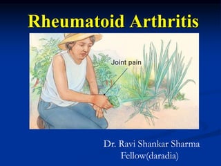Rheumatoid Arthritis
Dr. Ravi Shankar Sharma
Fellow(daradia)
 