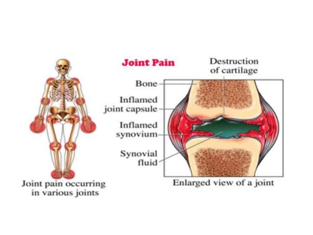 Arthritis Shoulder Pain Relief Diet