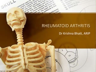 RHEUMATOID ARTHRITIS
Dr Krishna Bhatt, ARIP
 