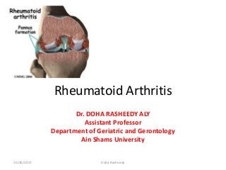 Rheumatoid Arthritis
Dr. DOHA RASHEEDY ALY
Assistant Professor
Department of Geriatric and Gerontology
Ain Shams University
10/26/2017 Doha Rasheedy
 