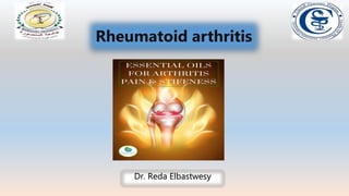 Rheumatoid arthritis
Dr. Reda Elbastwesy
 
