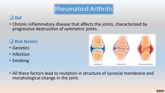Arthritis Treatment in Lahore, Pakistan - Causes - Diagnosis | Rehabcure