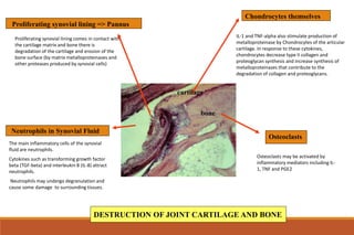 DESTRUCTION OF JOINT CARTILAGE AND BONE
Proliferating synovial lining => Pannus
Proliferating synovial lining comes in contact with
the cartilage matrix and bone there is
degradation of the cartilage and erosion of the
bone surface (by matrix metalloproteinases and
other proteases produced by synovial cells)
Chondrocytes themselves
IL-1 and TNF-alpha also stimulate production of
metalloproteinase by Chondrocytes of the articular
cartilage. In response to these cytokines,
chondrocytes decrease type II collagen and
proteoglycan synthesis and increase synthesis of
metalloproteinases that contribute to the
degradation of collagen and proteoglycans.
Neutrophils in Synovial Fluid
The main inflammatory cells of the synovial
fluid are neutrophils.
Cytokines such as transforming growth factor
beta (TGF-beta) and interleukin 8 (IL-8) attract
neutrophils.
Neutrophils may undergo degranulation and
cause some damage to surrounding tissues.
Osteoclasts
Osteoclasts may be activated by
inflammatory mediators including IL-
1, TNF and PGE2
bone
cartilage
 