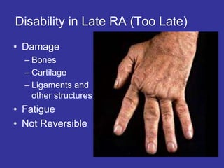 Disability in Late RA (Too Late)
• Damage
– Bones
– Cartilage
– Ligaments and
other structures
• Fatigue
• Not Reversible
 