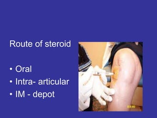 Route of steroid
• Oral
• Intra- articular
• IM - depot
 